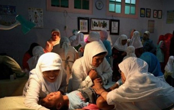 相比之下,非洲割礼常常涉及切除部分或全部的阴蒂(或阴蒂包皮).