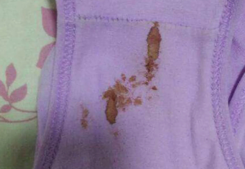 五岁女孩内裤上有血图片