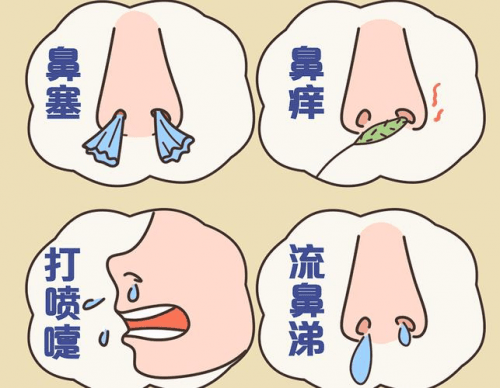 如果患者的鼻息肉比较小,症状比较轻微,则不需要做手术