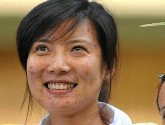 射击冠军杜丽:满脸痘痘消失,如今成"女神",39岁仍旧美丽动人