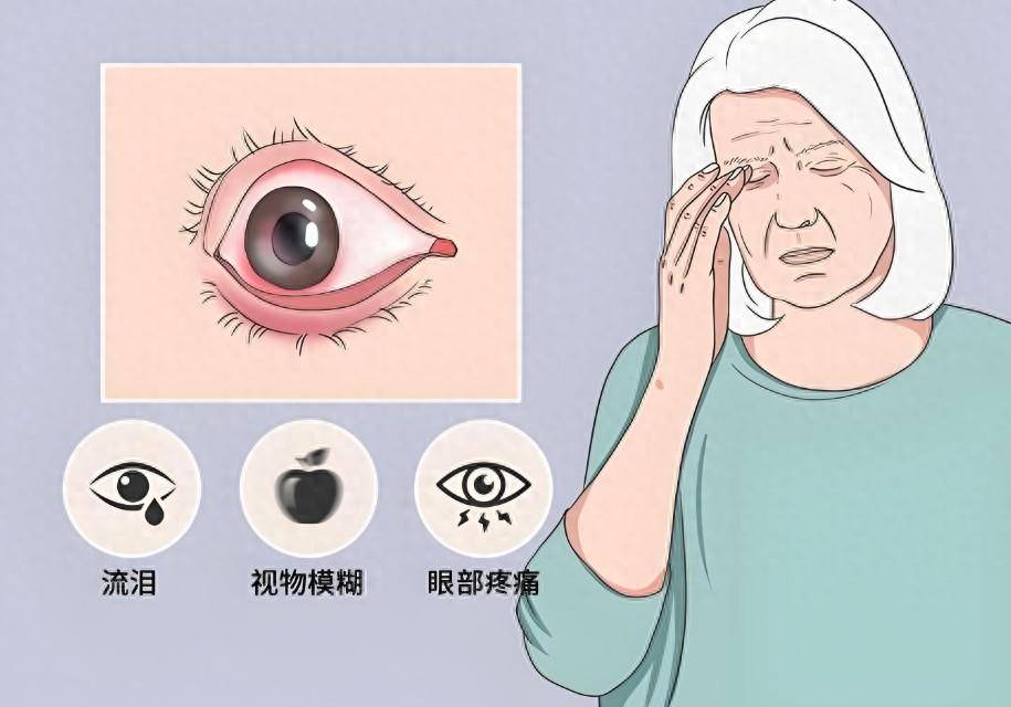 衡阳一男子连续熬夜后双眼"中病毒"_眼睛_症状_加班