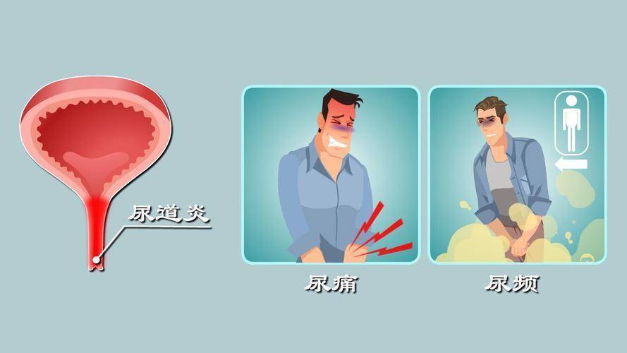 成都青羊天府医院医生解答男性泌尿问题,生活中怎么样保养?