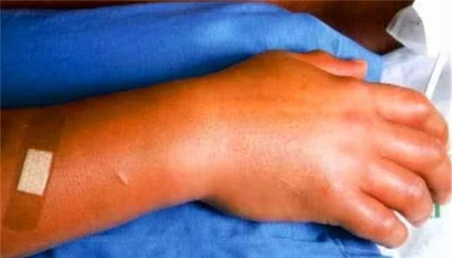 作用范围小且释放量大,因此距离最近的筱原和大内首当其冲成为受害者