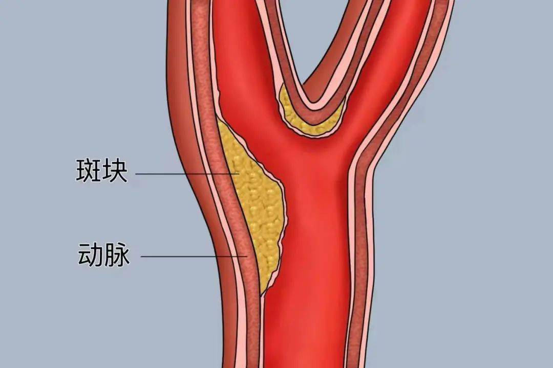 羊的颈部动脉血管图图片