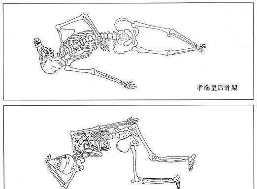 定陵被挖开后,万历皇帝尸骨姿势藏玄机