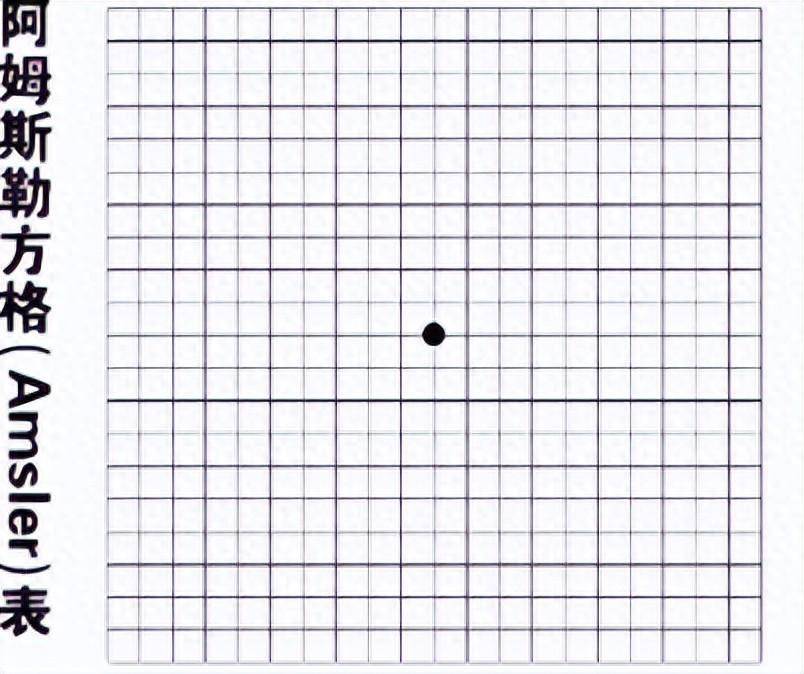 黄斑图测试图片