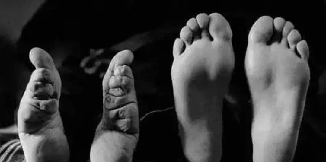 祸害中国女性800多年的缠足,有多泯灭人性?