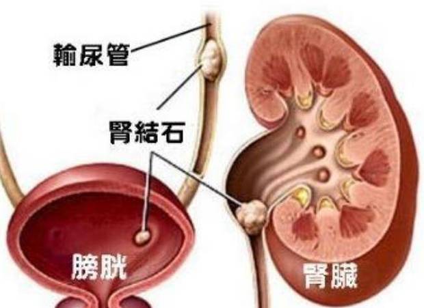 膀胱炎哪里疼图片