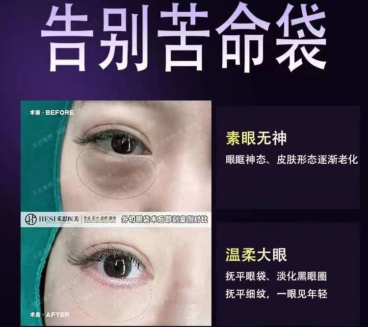 深圳做眼袋