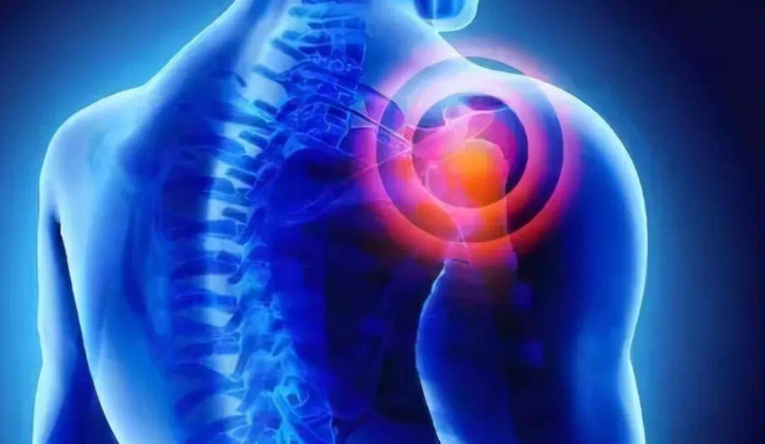 肩膀出现3种疼痛,可能是癌症前兆