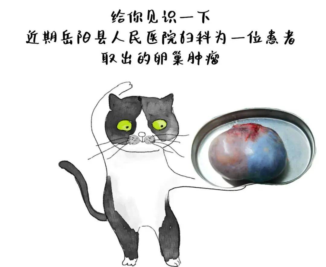 不"瘤"余地!老人腹藏"柚子大"肿瘤,幸有医生巧手"卸货"