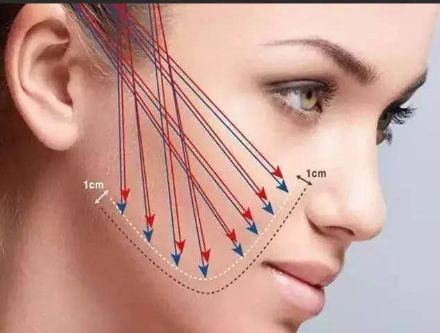 你知道吗拉皮手术的后遗症有哪些,做完拉皮手术后吃什么恢复的快