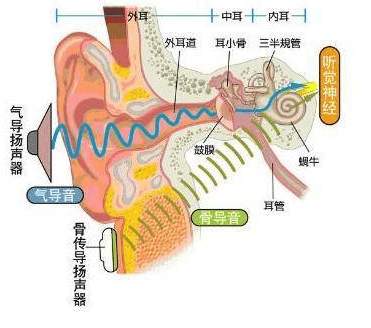 耳道式助听器结构图图片