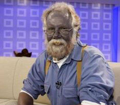 世界最罕见的蓝种人:隐居在6000米的深山,100多年仅下山了一次