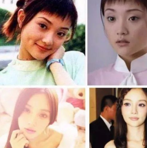 后期,李小璐不仅眼睛变得更大,双眼皮也是变得更宽了,脸僵,苹果肌也略