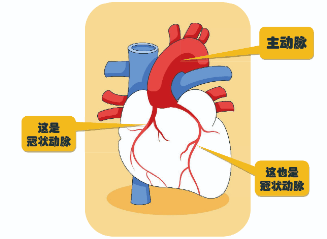 心脏支架位置图片