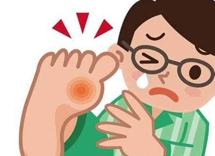 痛风有没有,见到脚趾头就知道了,有三大表现,得5招才能治愈!