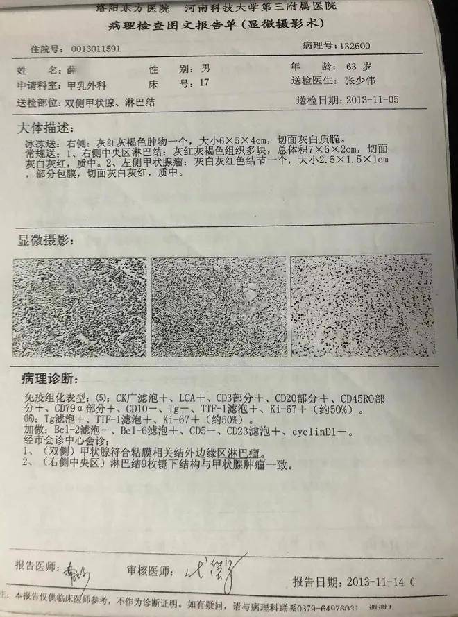 淋巴瘤11年抗争史:手术 化疗复发,中药助他重获新生