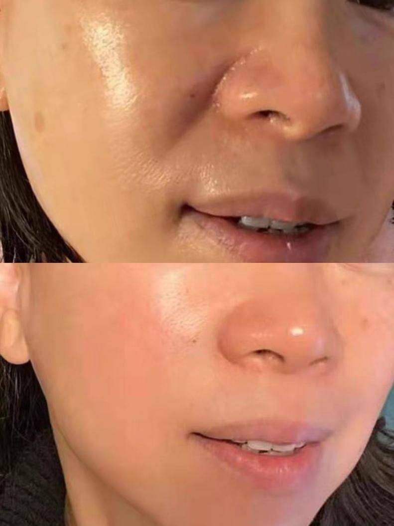 盘点去皱纹最好的方法!