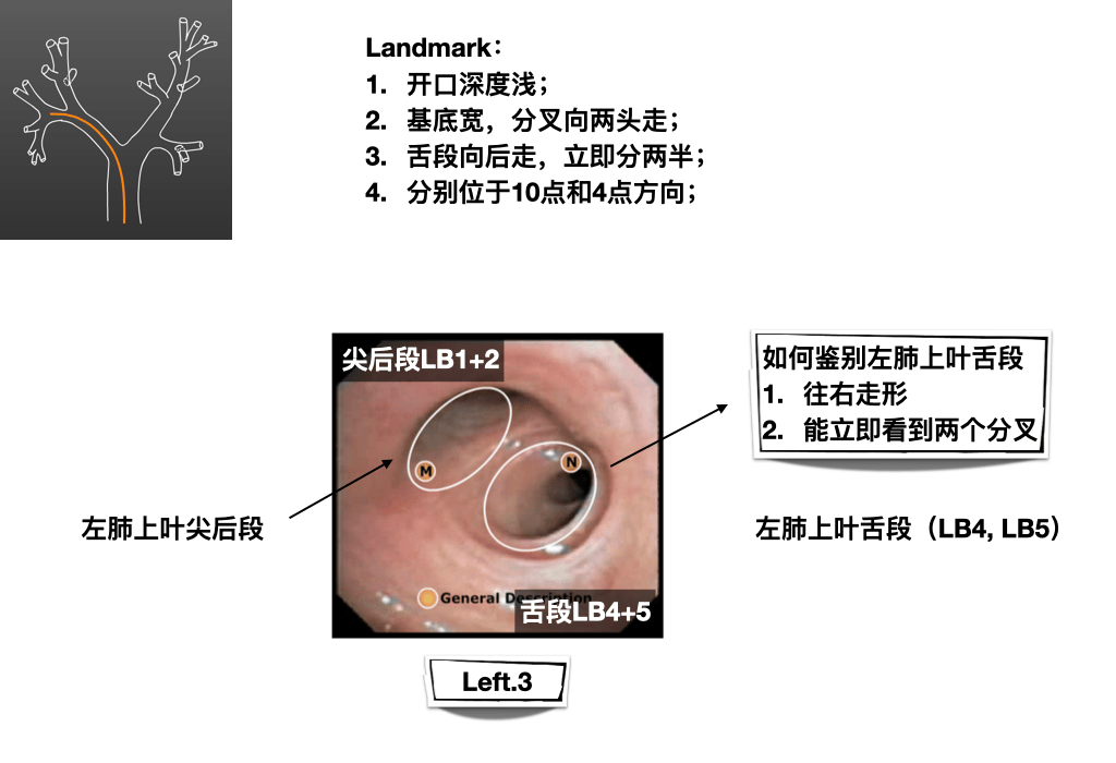 临床必备|纤维支气管镜入门图谱,一文分享!超实用!