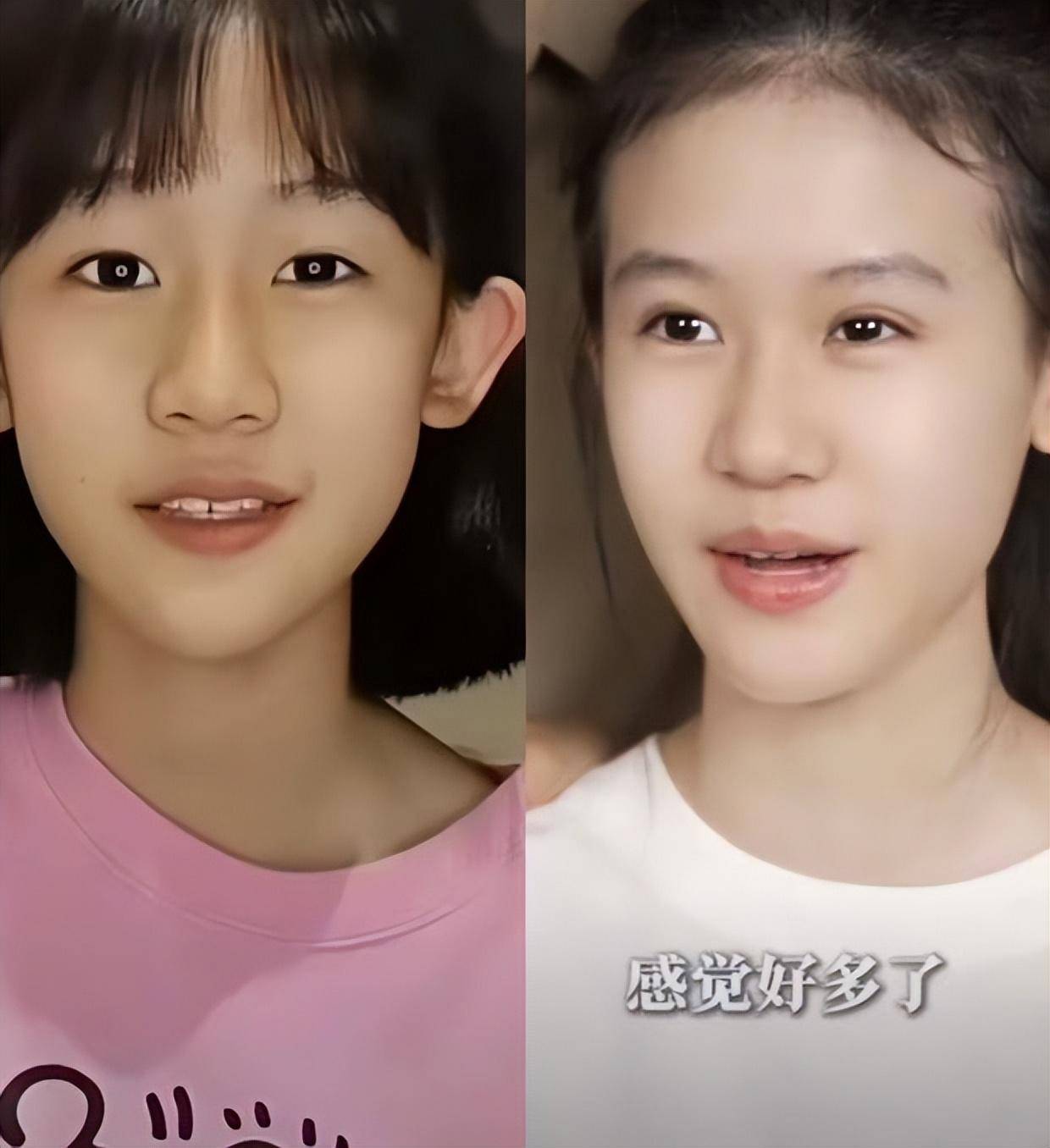 陆毅大女儿贝儿近照曝光:眼睛变化引热议,是成长魔力还是另有隐情?