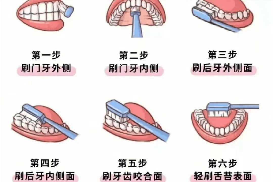 保护牙齿步骤图图片