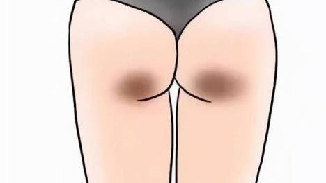 首先,要避免久坐.