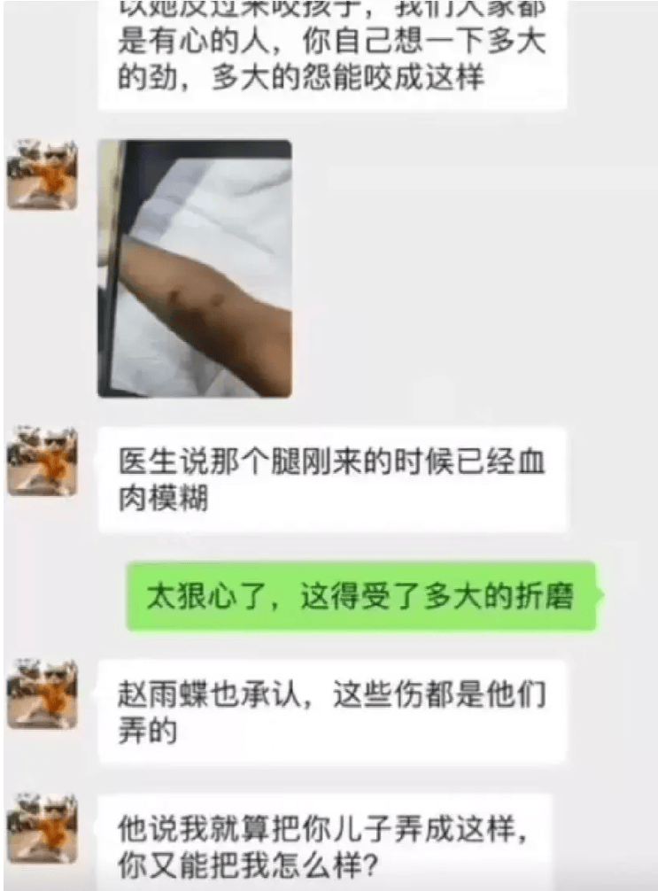 疑遭生父女友虐待的3岁半幼童离世,亲父称不知情