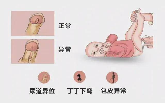 上海程开祥教授 丁丁有没有这几种情况