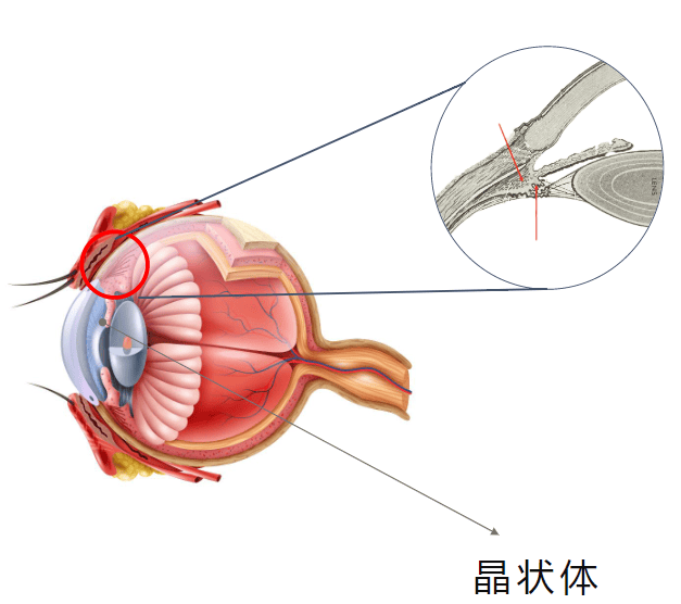 晶状体图解图片