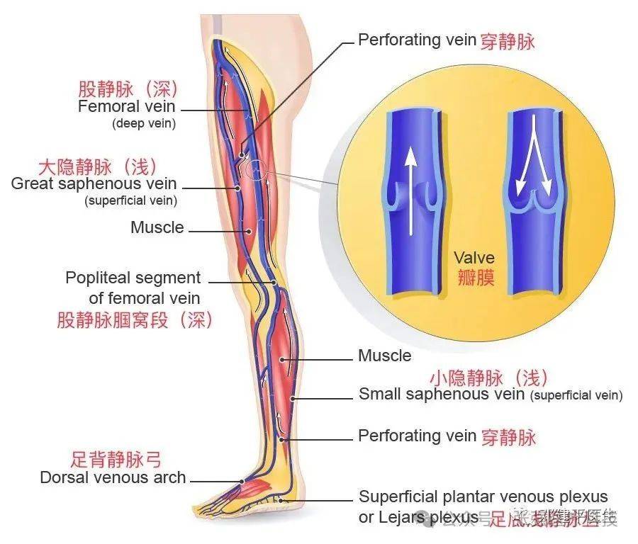 邓建平医生 | 扁平足,足弓高,也会影响静脉曲张?