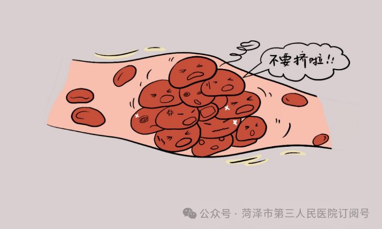 动起来 “栓”不住——菏泽市三院带您了解静脉血栓栓塞_下肢_进行_症状