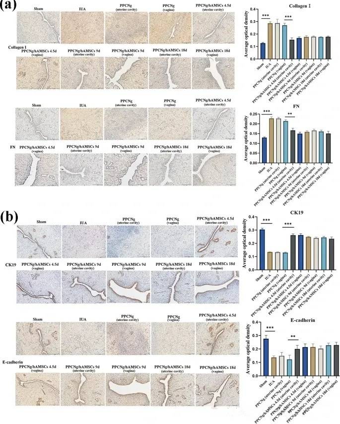 外泌体研究新发现:间充质干细胞通过旁分泌作用促进子宫内膜修复
