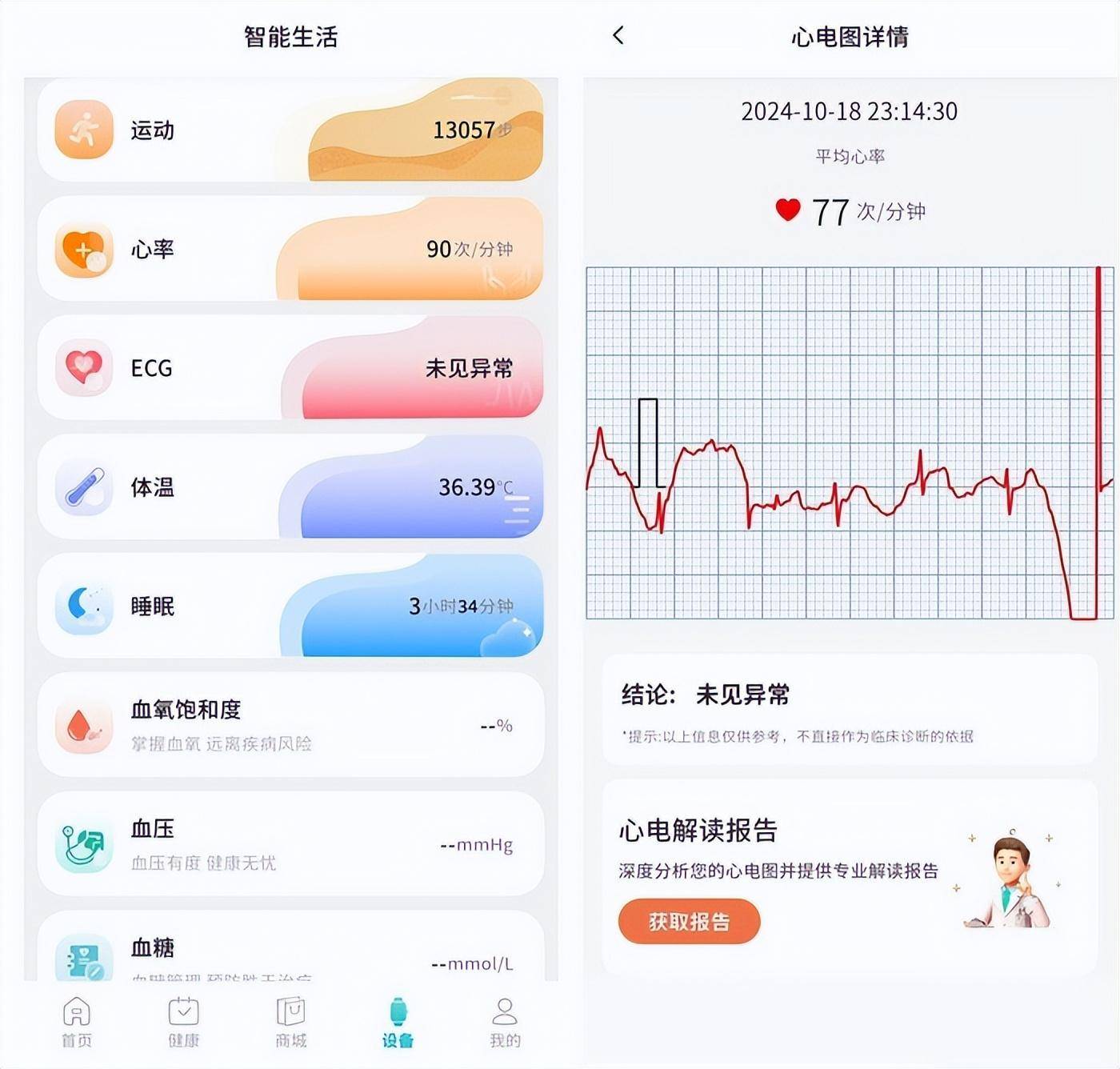 智慧健康的未来 圆道妙医心电手表