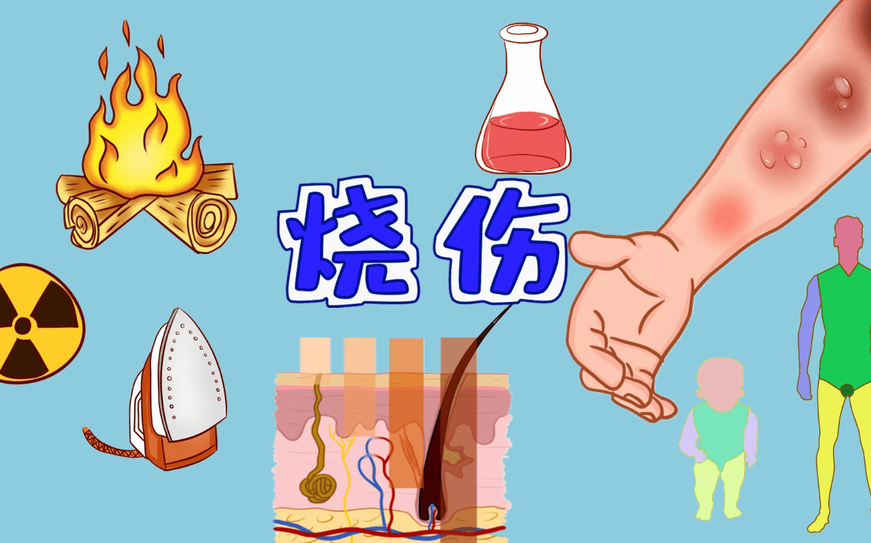 让你对一至五级烧伤有了认知-百货之家
