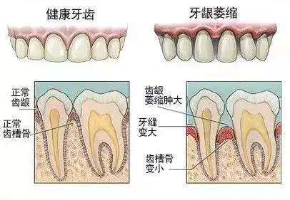 牙床部位图解图片