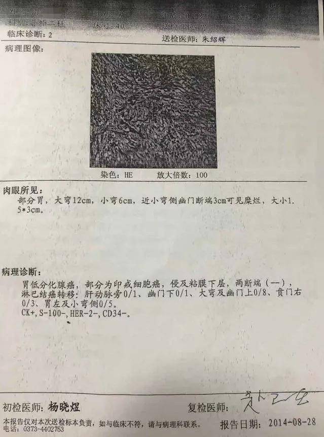 胃癌10年,手术以后吃中药没想到现在这么稳定!