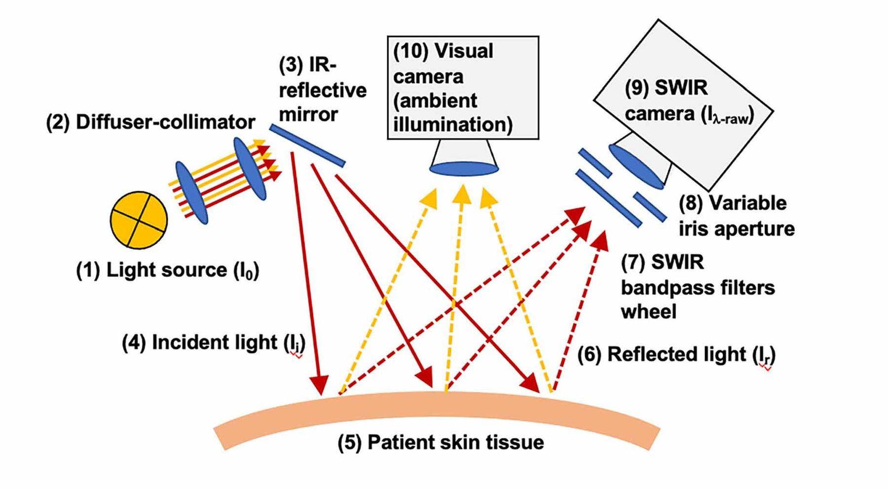 SWIR成像| 利用新型多光谱短波红外成像评估人体烧伤创面的深度_搜狐网