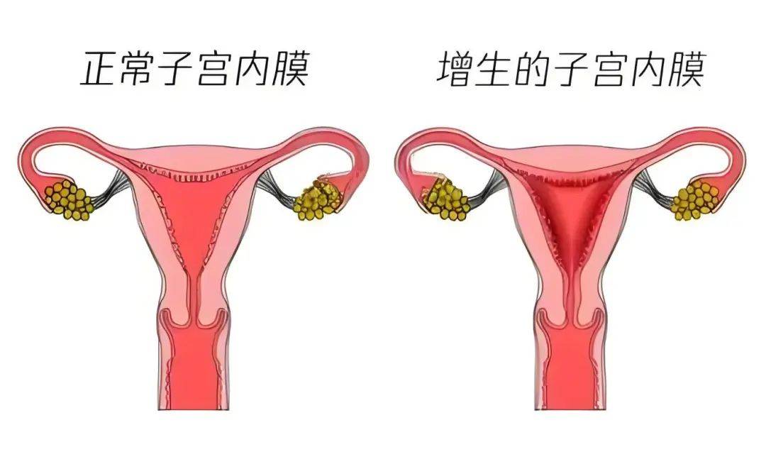 大家好,今天想给大家聊一聊女性常见病症