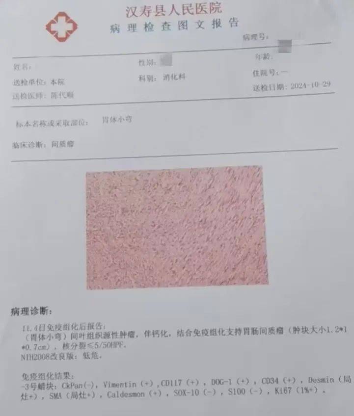 胃体小弯低分化腺癌图片