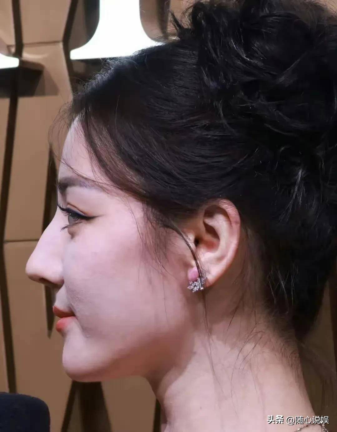 明星怼脸拍生图无滤镜下的真面目谁好谁差一目了然