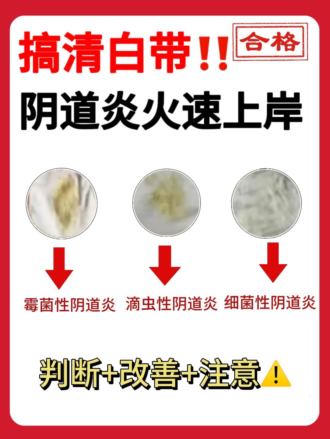 真颠哪!搞清白带颜色阴道炎竟然火速上岸了