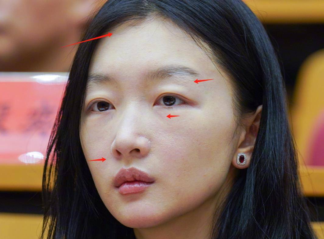 明星无滤镜大变样,董洁太粗糙,周冬雨肿眼泡,林心如似大婶子