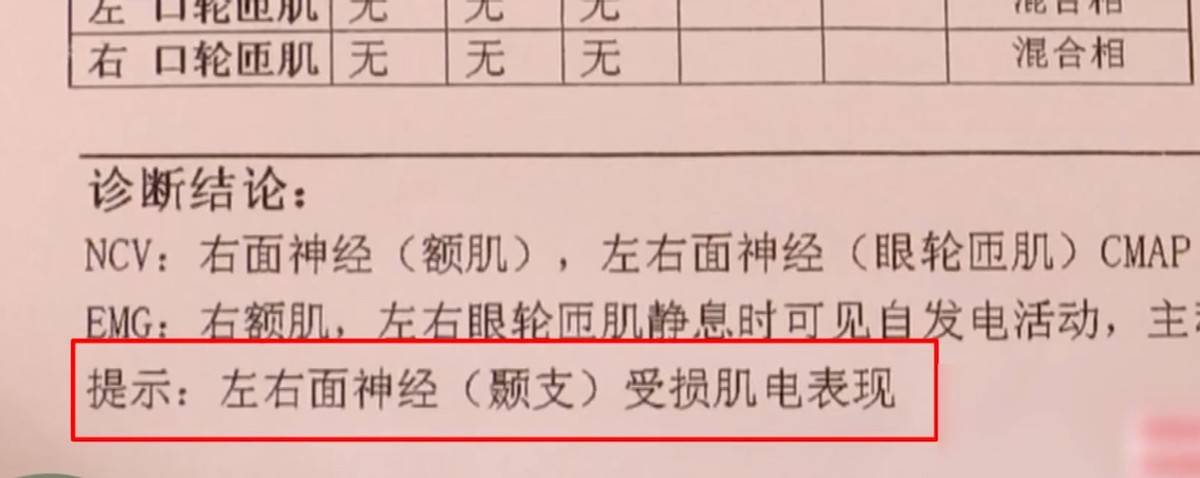 拉皮后眉毛不能动 宁波鄞州童颜医疗美容黑历史洗白难(图9)