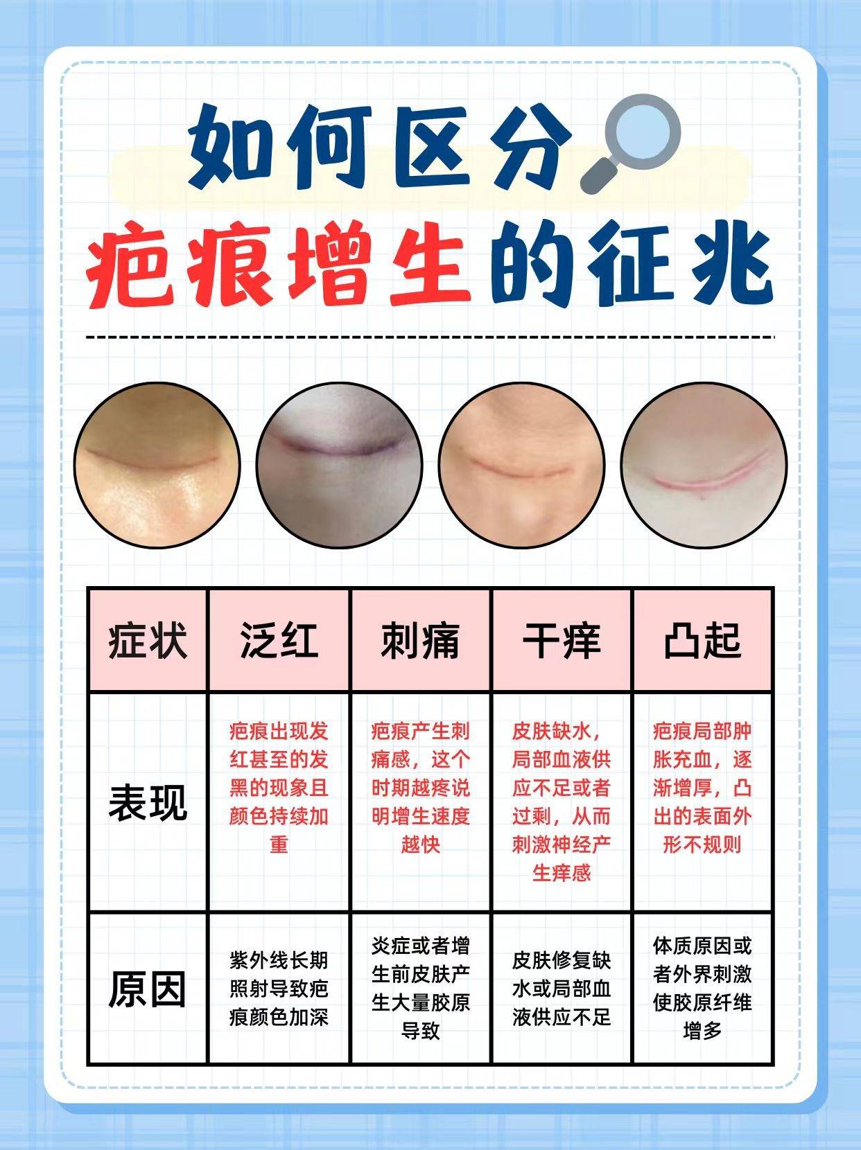 为什么伤口愈合会有疤痕百科在线