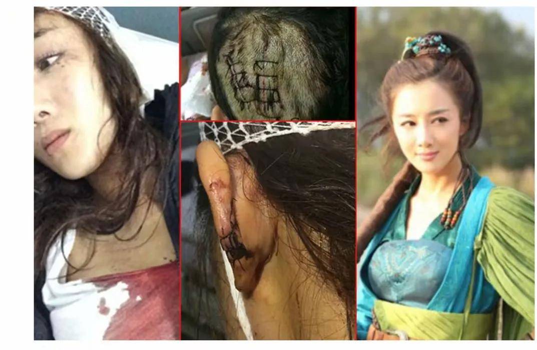 被狗咬毁容后,现在41岁靠演坏女人逆袭成功