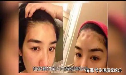 女性自我保护的重要性蔷蔷和黄奕的故事都给我们敲响了警钟,她们所