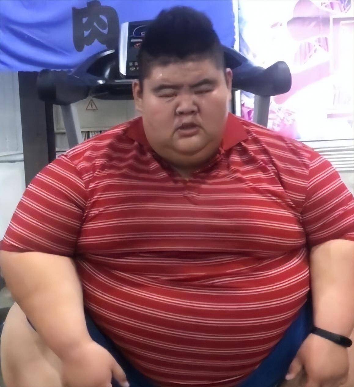 "中国首胖"王浩楠,切胃暴瘦480斤成网红,之后出轨与娇妻离婚