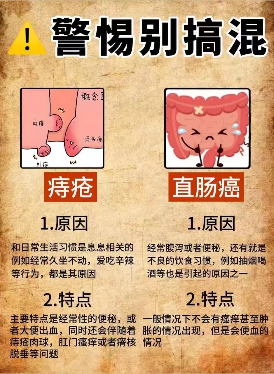 问题大揭密:痔疮肉球和直肠癌的区别!