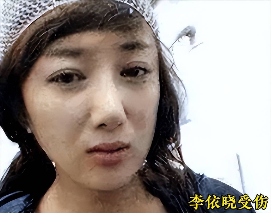 李依晓:曾是古装美人,被狗咬毁容的她,如今通过助演成功翻身!